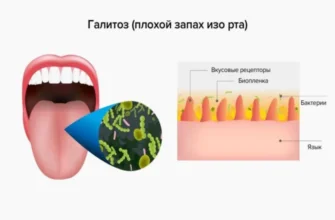 nemanex drops - zloženie - účinky - komentáre - recenzie - nazor odbornikov - cena - Slovensko - kúpiť - lekáreň