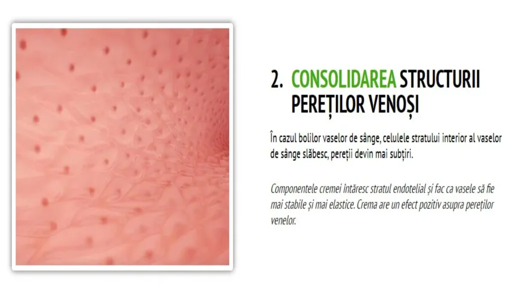 Varilux premium - sito ufficiale - composizione - prezzo - Italia - opinioni - recensioni - in farmacia